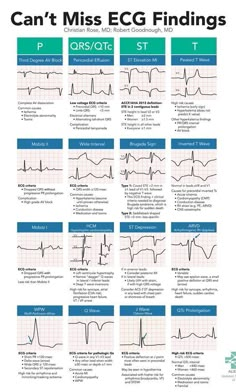 Medische Humor, Critical Care Nursing, Nursing School Studying, Nursing School Tips