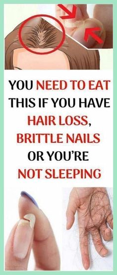 Positive answer to the questions we are going to put bellow may indicate that there is a disruption of your adrenal glands, although it may not always be the case. Hair Care Frizzy, Best Oil For Hair, Pregnancy Hair, Argan Oil For Hair, Adrenal Gland, Natural Hair Oil, African American Hair Care, Blonde Hair Care, Postpartum Hair