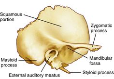 the bones of the skull are labeled