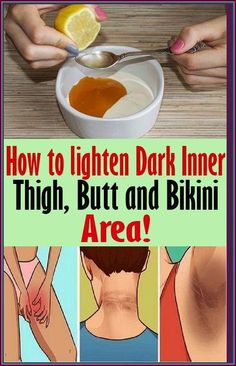 Whiten Underarms Fast, Dark Inner Thighs, How To Whiten Underarms, Tiny Shorts, Dark Underarms, Health Signs, Face Wrinkles, Micro Mini Skirt, Inner Thigh