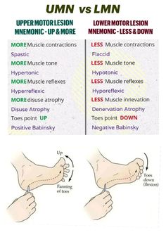 the differences between upper and lower limbs in foot reflexs, including an upper limb