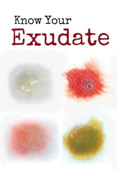 the cover of know your exidate book with four different colored stains on it