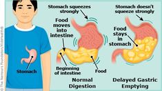 Easily Digested Foods, Oxalate Diet, Low Oxalate, Yoga Information, Stomach Muscles, Fun Questions, Sciatic Nerve Pain, High Fat Foods