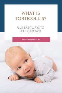 torticollis