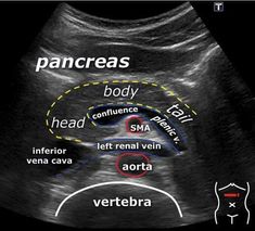 an x - ray shows the location of pancreas and other areas of the body