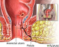 Arteries And Veins, Disease Symptoms, Immune Response, Good Doctor, Autoimmune Disease, A Team, Disease, Health Care, Medical