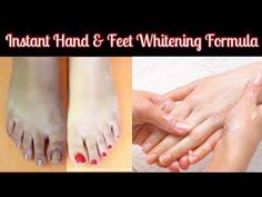 Hi EveryoneIn this video I will show how to do pedicure and hands care at home ..we all love pedicure but going to polar is expensive..All ingredients are ea... Hand And Feet Care, How To Do Pedicure, Hands Care, Dry Legs, Hand & Foot Cream, Hand And Foot Care, Foot Scrub, Easy Yoga Workouts