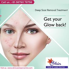 Hair Advertising, Face Mapping Acne, Get Clear Skin, Skin And Hair Clinic, Aesthetic Post, Oily Skin Acne, Skin Aesthetics, Cosmetic Clinic