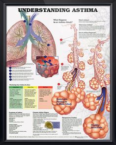 an image of the human body and lungs with captioning information on it,