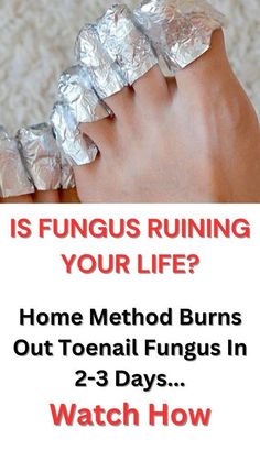 Fungal Infection Remedies, Healthier Skin, Fungal Infection