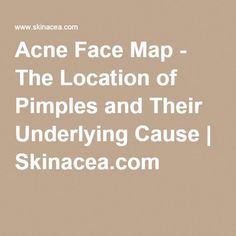 Body Acne Map, Pimple Under The Skin, Face Mapping Acne, Face Mapping, Under The Skin, Body Acne