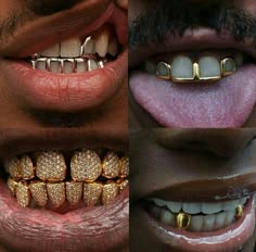 Open Face Grillz Men, Mouth Jewelry, For White Teeth, Mouth Grillz, Gold Grills, Girl Grillz, Pretty Teeth, Dental Jewelry, Grillz Teeth