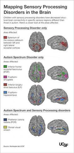 Kids with Autism, Sensory Processing Disorders Show Brain Wiring Differences | UC San Francisco Processing Disorder, Sensory Issues, Counseling Resources, Learning Methods, Sensory Processing Disorder