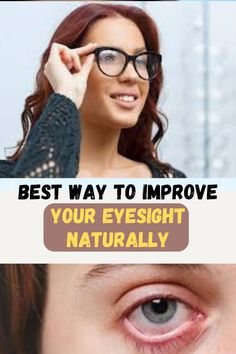 Food For Eyes, Happy Eyes, Blurry Vision, Weight Changes, Eye Sight Improvement, Vision Eye, Eye Exercises, Vision Problems, Cold Sores Remedies