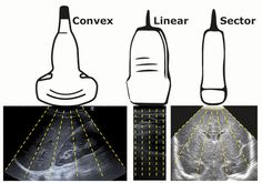 an x - ray shows the different stages of breast surgery, and how they are performed