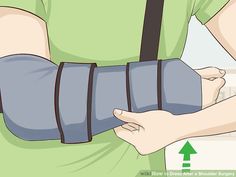 4 Ways to Dress After a Shoulder Surgery - wikiHow Arthroscopic Shoulder Surgery, Post Surgery Bra