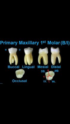 Tooth Surfaces, Dental Ceramics, Dental Hygiene Student, Dental Hygiene School, Dentistry Student, Dental Anatomy, Dental Facts