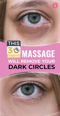 Eye Circle Remedies, Dark Circle Remedies, Eye Massage, Dark Eye Circles, Remove Dark Circles, Under Eyes, Dark Circles Under Eyes, Reduce Dark Circles, Dark Under Eye