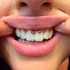 a woman with braces on her teeth is smiling and holding her nose up to the camera