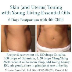 Essential Oils Skin, Essential Candles, Essential Oil Remedy, Young Living Essential Oils Recipes, Oil Remedies, Yl Essential Oils, Living Essentials Oils, Living Essentials, Post Partum