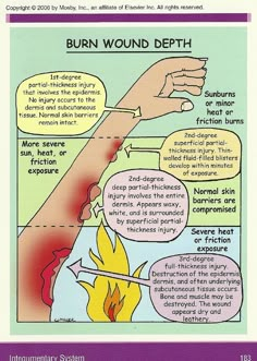 Burn Wound, Nursing School Tips, Medical School Studying, Nursing School Notes, Medical School Essentials, Medical Anatomy