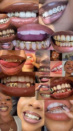 many different pictures of people with braces on their teeth