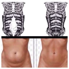 Exercises for Diastasis Recti (1) the separation in your abdomen after having children Diástase Abdominal, Diastasis Recti Exercises, Body After Baby, Modele Fitness, Mommy Workout, Diastasis Recti, Post Pregnancy, Diet Keto