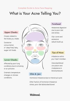 Acne Breakout Chart, Things To Help Acne, What Acne On Your Face Means, How To Help Acne, What Helps Acne, Pimple Chart Meaning, Acne Prone Skin Tips, Skincare To Help With Acne, Facial Skin Care Routine Acne