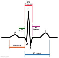 Components of a normal sinus rhythm Ekg Rhythms, Normal Sinus Rhythm, Pr Interval, Cardiac Rhythms, Medical Library, Atrial Fibrillation