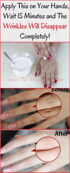 Tips Hair, Skin Nails, Beauty Remedies, Hand Care, Homemade Beauty Products, Beauty Treatments, Hair Skin, Skin Treatments, Beauty Secrets