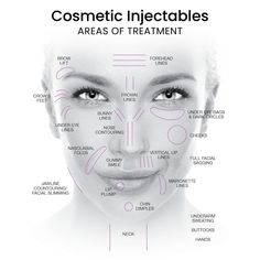 Face Analysis, Cosmetic Injections, Sagging Cheeks, Cosmetic Fillers, Facelift Procedure, Forehead Lift, Aesthetic Marketing, Forehead Lines, Under Eye Fillers