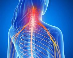 La hernie discale cervicale concerne les disques intervertébraux situés au niveau du cou. Découvrez les symptômes et les traitements de cette douleur. Pinched Nerve In Neck, Cervical Disc, Neck And Shoulder Muscles, Cervical Traction, Neck Pain Relief, Neck And Back Pain