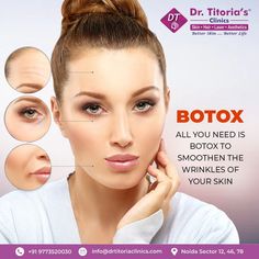 Improve your appearance by smoothening the wrinkles of your skin. You cannot control ageing, but, botox can do it in a medically approved way. The skin specialists of Dr. Titoria’s Clinic are a call away at (+91 9773520030) for offering a tailored treatment. #botox #botoxtreatment #wrinkles #reducefinelines #skincare #dermatologist #skinbeauty #dermatology #drtitoriasclinics #skinspecialists #skintreatment #skinexperts #skincareclinic #skinsolution Botox For Wrinkles, Skincare Dermatologist, Botox Wrinkles, Skin Specialist, Skin Care Clinic, Laser Hair, Dermatology, Better Skin