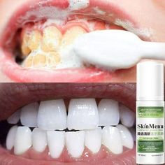 Toothpaste-Foam-Mousse-Whitening-Stain-Remove-Plaque-Teeth-Hygiene-Oral-Cleaning-60ml-Essence-Natural Size: One Size.  Color: Green. Baking Soda Toothpaste, Plaque Teeth, Tooth Whitening, Teeth Whitening Remedies, Teeth Whitening Diy, Stained Teeth, Natural Teeth Whitening, Tea Tasting, Natural Teeth