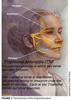 an image of a woman's face with her branches labeled in blue and yellow