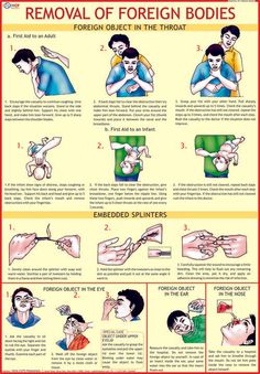 Removal of Foreign Bodies Chart First Aid Cpr, Body Chart, First Aid Tips, Emergency Preparedness Kit, Survival Life Hacks, Survival Techniques, Emergency Medicine, Survival Life, Disaster Preparedness