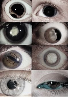 several different types of eyes with the same amount of contact between them and one that appears to be an eyeball