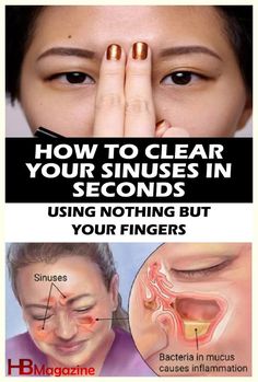 How to Clear Your Sinuses in Seconds Using Nothing but Your Fingers Sinus Blockage, Cold Or Allergies, Sinus Congestion, Sinus Infection, Honeymoon Travel, Acupressure, Wellness Tips