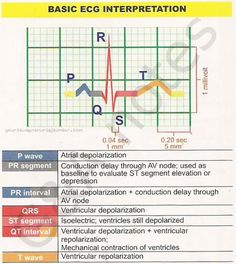 Basic ECG Interpretation Ekg Interpretation, Ecg Interpretation, Nursing Schools, Critical Care Nursing, Respiratory Therapy