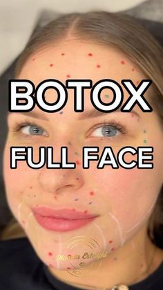 Botox Business, Filler Face, Facial Harmony, Aesthetic Nursing, Arm Workout Gym, Face Fillers, Aesthetic Dermatology, Botox Cosmetic