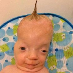 a balding baby sitting in a bath tub with his head on the back of it's head