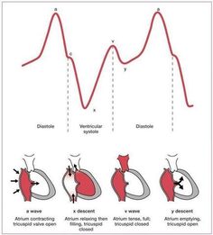 Curvas presión venosa Cath Lab Nursing, Central Venous Pressure, Medications Nursing, Heart Nursing, Cardiac Cycle, Medical Library, Philip Roth