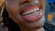 #grillz #gold #lips #gloss Open Face Grillz For Women, Grillz For Females Black, Fangs Grillz Women, Grillz With Gap, Grillz For Females, Female Grills, Girly Grillz Gold Grill, Mouth Grillz, Grillz Girls Teeth