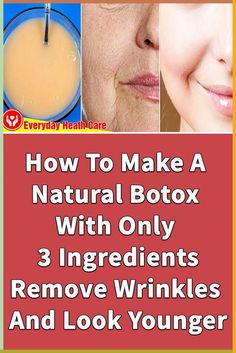 If you want to Get Rid Of Wrinkles On The Face but without injecting potentially damaging chemicals into the body, we will guide you on how to make a natural... Face Wrinkles Remedies, Wrinkles Remedies Face, Natural Botox, Facial Wrinkles, Skin Care Wrinkles, Face Wrinkles, Wrinkled Skin, Homemade Face