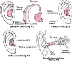 ear diagram with different parts labeled