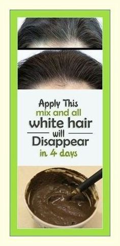 Get Rid Of White Hair, Croquettes, Grey Hair, Simple House, White Hair, For Hair