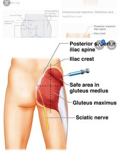 an image of the anatomy of the thigh and lower limb with labels on each side