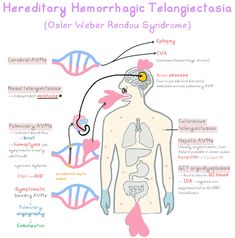 diagram of the human body with text describing how it is used to treat hemorrhgic