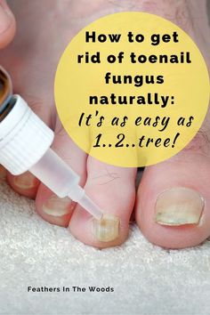 Toenail Health, Nail Remedies, Toenail Fungus Remedies, Nail Fungus Remedy, Nail Infection, Tongue Health, Natural Health Care