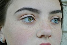 Two Different Eye Colors People, Different Color Eyes Heterochromia, People With Heterochromia, Heterochromia Eyes Aesthetic, Heterochromia Eyes, Different Colored Eyes, Body Photography, Stunning Eyes